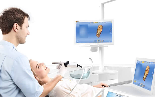 Hochwertige zahn Keramikrestauration mit CEREC-Technologie | Swiss Smile  